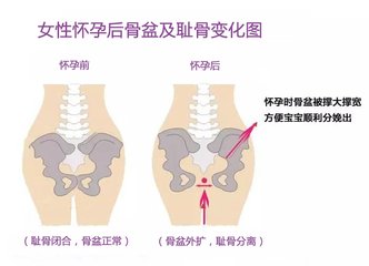 产前产后对比