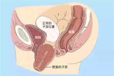 产后会出现的各种问题