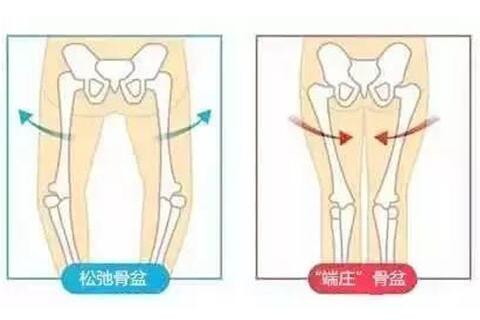 骨盆修复示意图