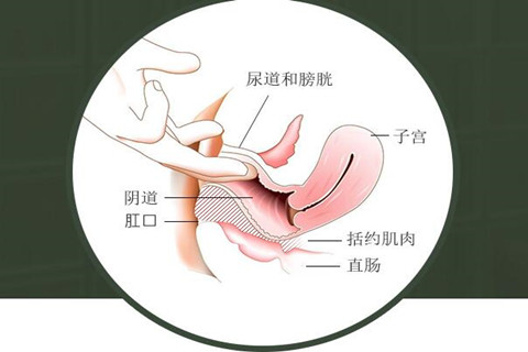 后方膣圆盖术手术示意