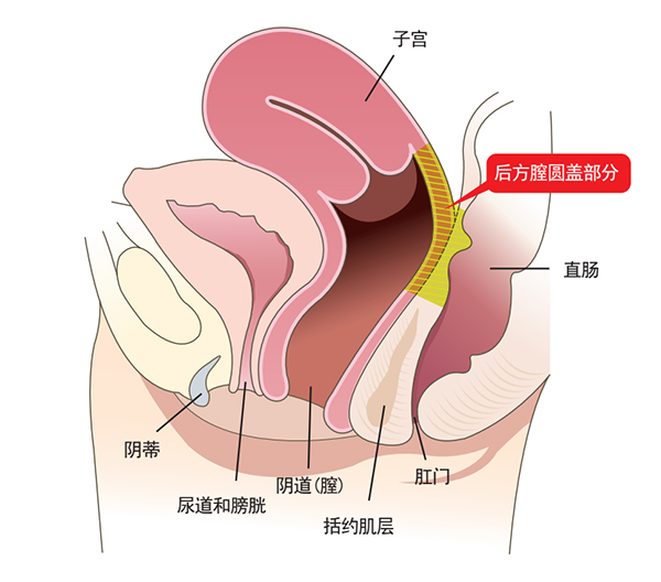 子宫下垂能自愈吗