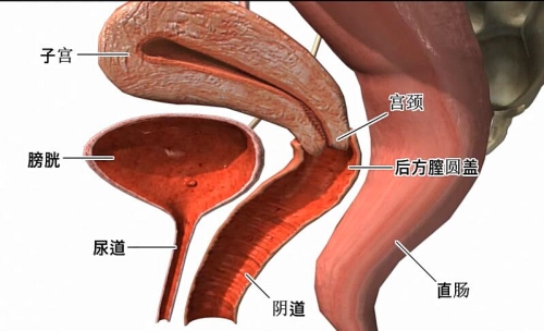 后方膣圆盖缩阴手术