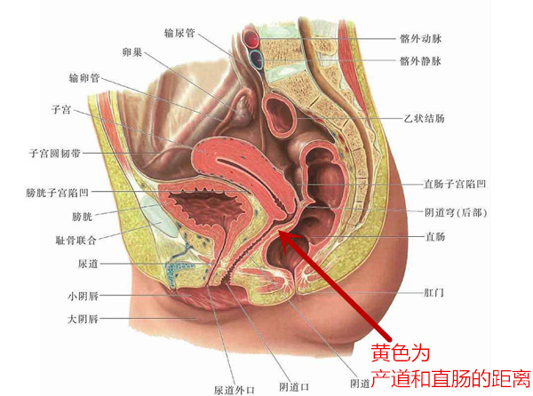 缩阴手术过程
