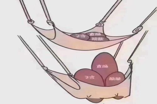 好手艺妇科盆底肌松弛