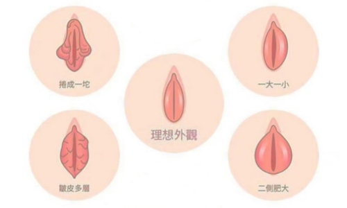 小阴唇.jpg