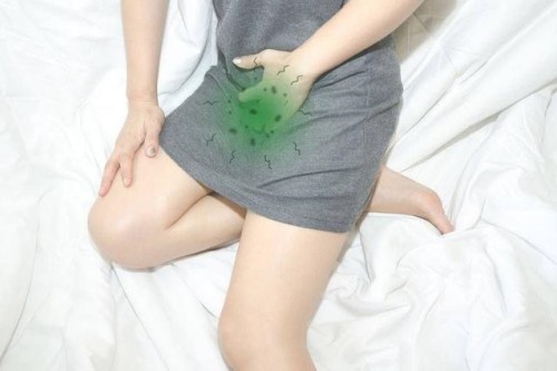 妇科疾病