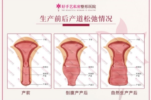 私密手术